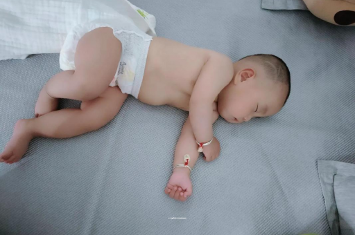 涉县六个月宝宝眼睛散光